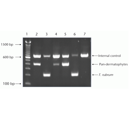 Dermatophyten-PCR-medco