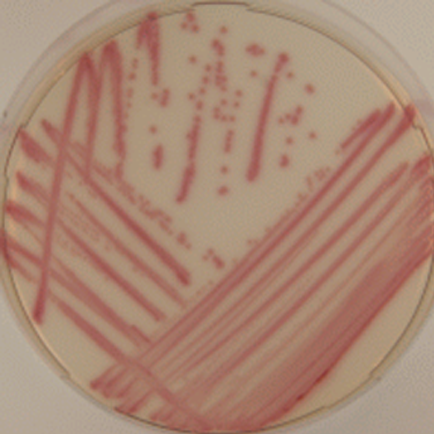 Enterobacter-cloacae-medco